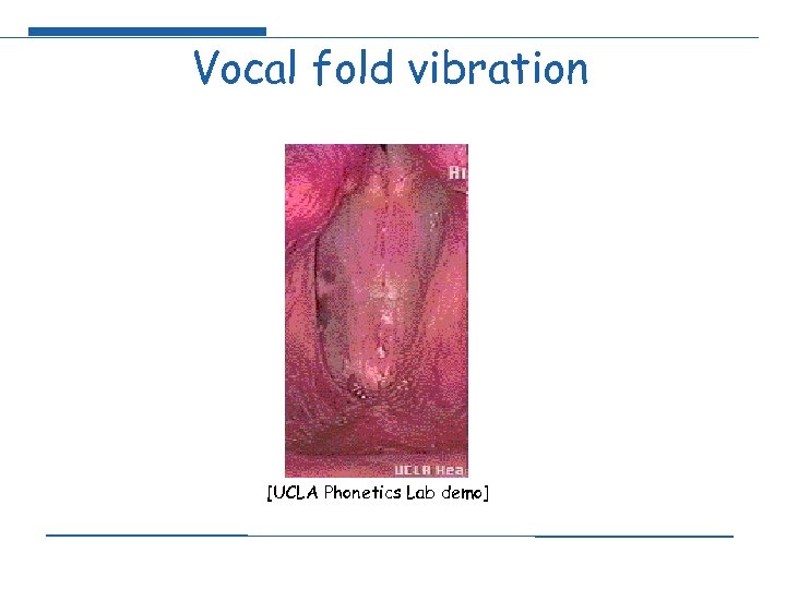 Vocal fold vibration [UCLA Phonetics Lab demo] 