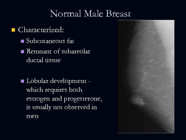 Normal Male Breast n Characterized: Subcutaneous fat n Remnant of subareolar ductal tissue n