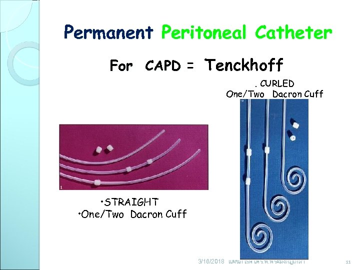 Permanent Peritoneal Catheter For CAPD = Tenckhoff. CURLED One/Two Dacron Cuff • STRAIGHT •