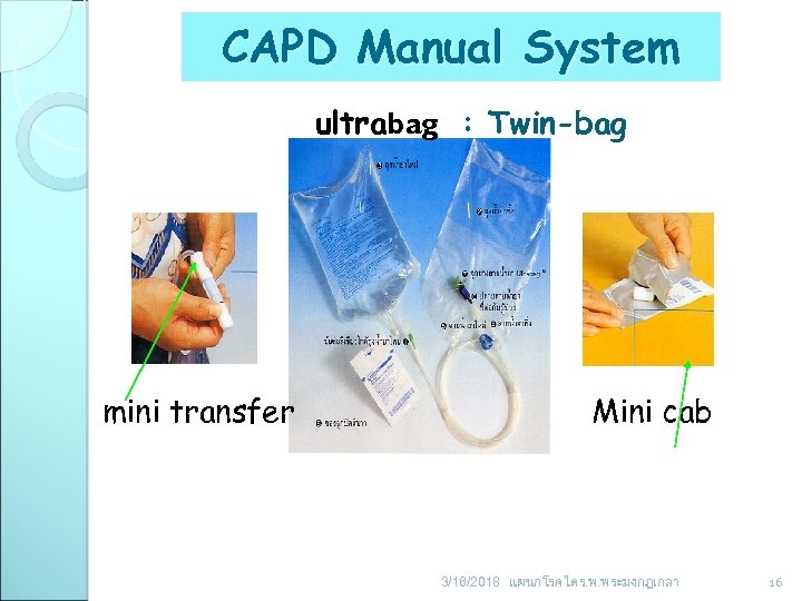 CAPD Manual System ultrabag : Twin-bag mini transfer Mini cab 3/16/2018 แผนกโรคไต ร. พ.