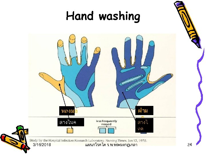 Hand washing ฝาม อ หลงมอ ลางไมค อยถง 3/16/2018 ลางไ ดด แผนกโรคไต ร. พ. พระมงกฎเกลา