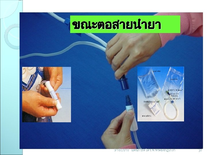 ขณะตอสายนำยา 3/16/2018 แผนกโรคไต ร. พ. พระมงกฎเกลา 30 