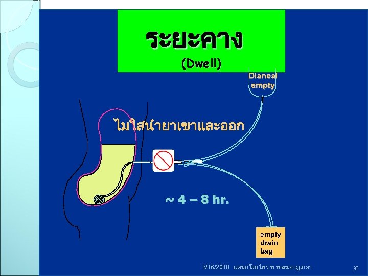 ระยะคาง (Dwell) Dianeal empty ไมใสนำยาเขาและออก ~ 4 – 8 hr. empty drain bag 3/16/2018