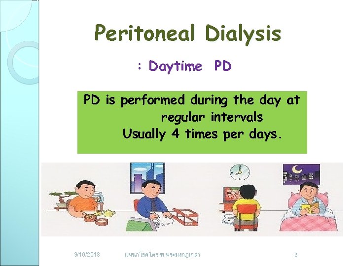 Peritoneal Dialysis : Daytime PD PD is performed during the day at regular intervals