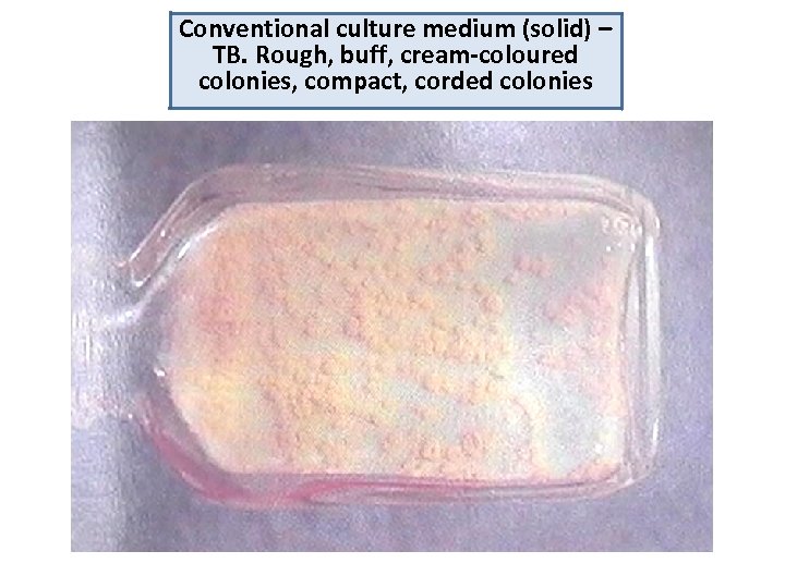 Conventional culture medium (solid) – TB. Rough, buff, cream-coloured colonies, compact, corded colonies 