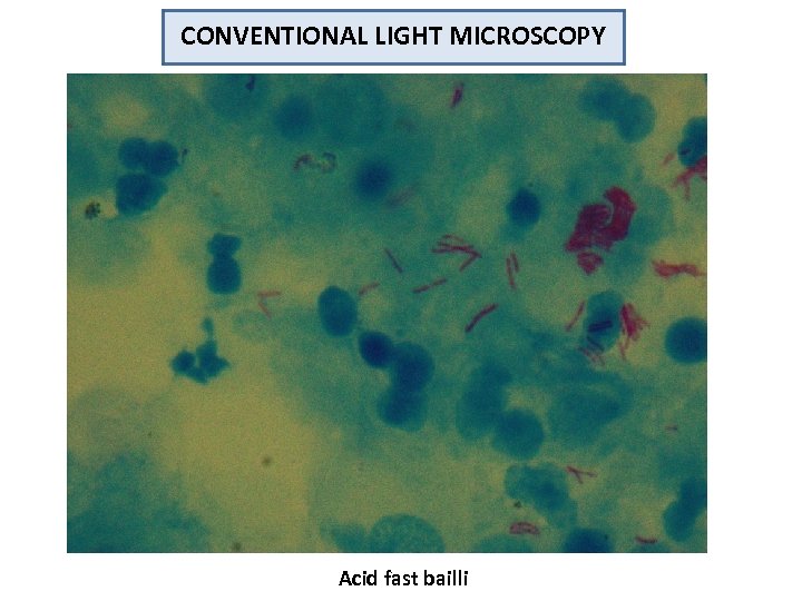 CONVENTIONAL LIGHT MICROSCOPY Acid fast bailli 