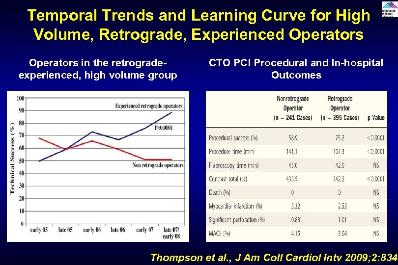 Temporal Trends and Learning Curve for High Volume, Retrograde, Experienced Operators in the retrogradeexperienced,