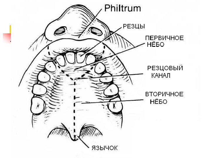 Резцовый. Первичное и вторичное небо. Первичное твердое небо.