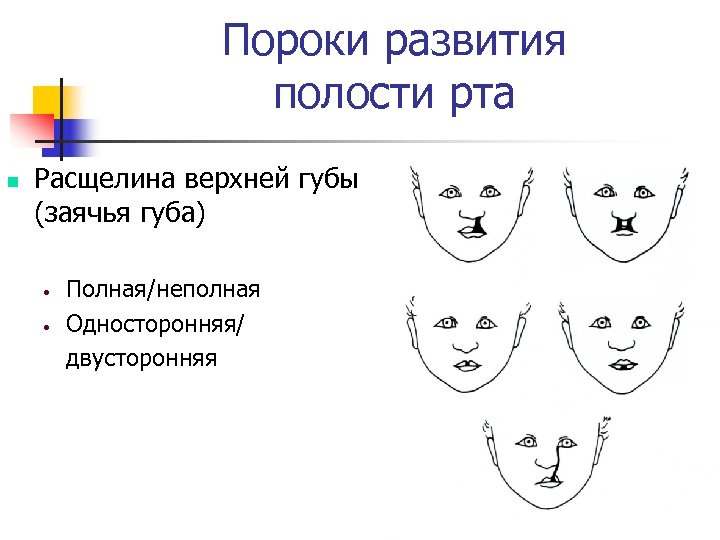 Формирование лица. Пороки развития полости рта. Развития пороки развития полости рта. Врожденные пороки развития лица и полости рта. Врожденные дефекты полости рта.