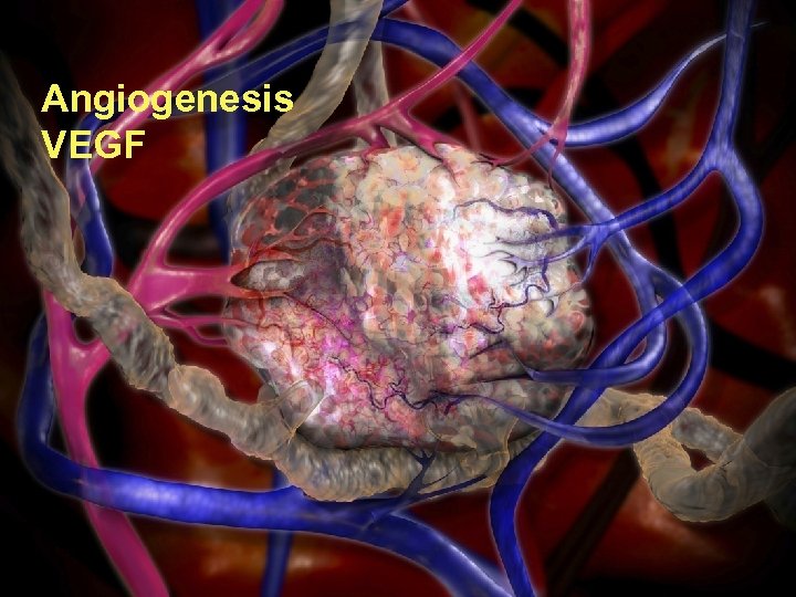 6 th International Symposium on Translational Research in Oncology Angiogenesis VEGF clinicaloptions. com/oncology 