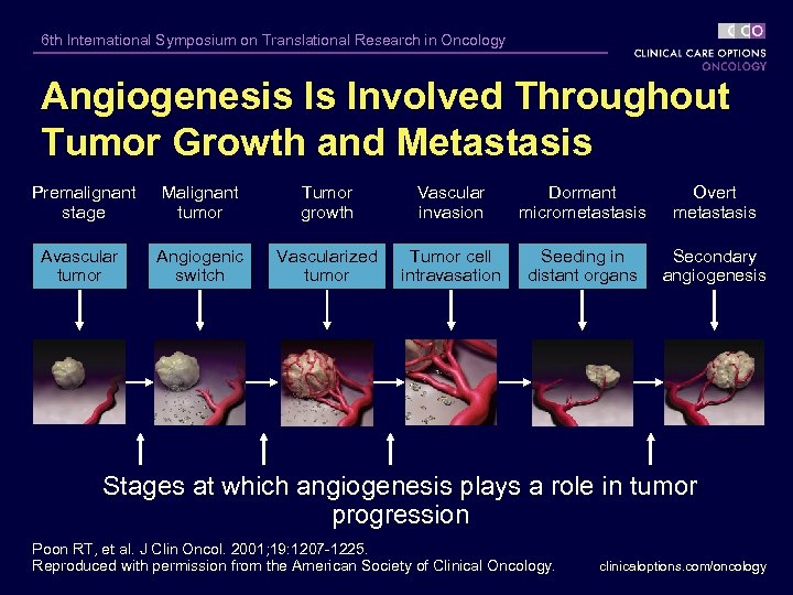 6 th International Symposium on Translational Research in Oncology Angiogenesis Is Involved Throughout Tumor