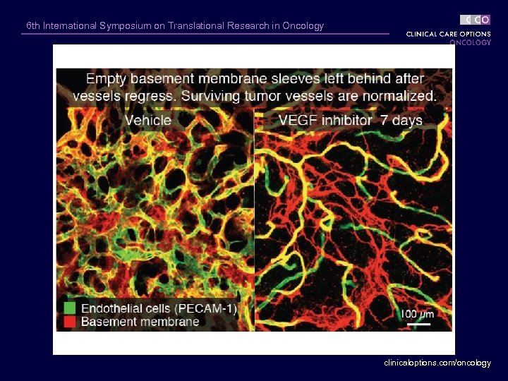 6 th International Symposium on Translational Research in Oncology clinicaloptions. com/oncology 