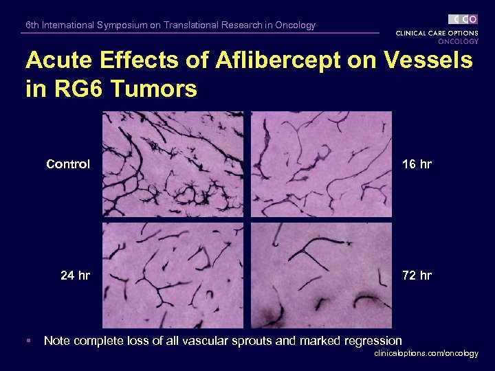 6 th International Symposium on Translational Research in Oncology Acute Effects of Aflibercept on