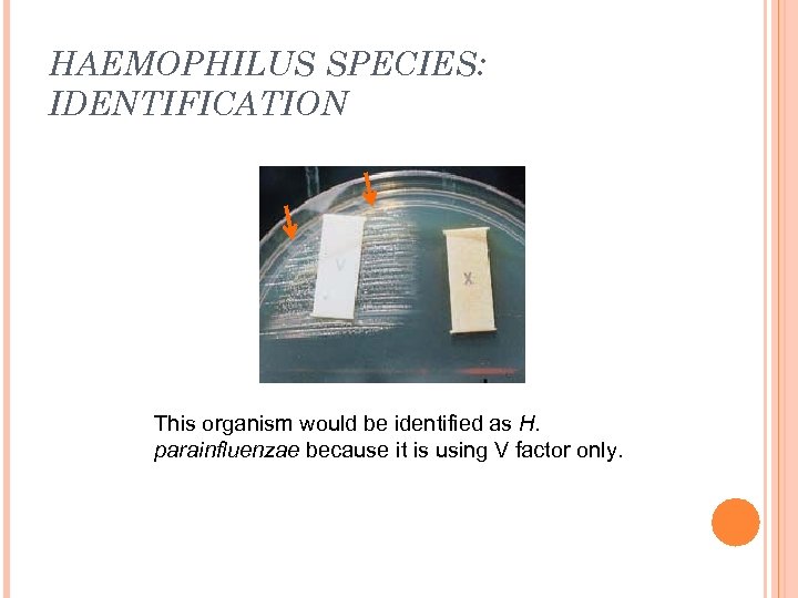 HAEMOPHILUS SPECIES: IDENTIFICATION This organism would be identified as H. parainfluenzae because it is