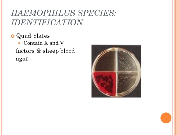 HAEMOPHILUS SPECIES: IDENTIFICATION Quad plates Contain X and V factors & sheep blood agar