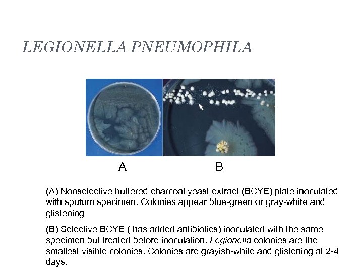 LEGIONELLA PNEUMOPHILA A B (A) Nonselective buffered charcoal yeast extract (BCYE) plate inoculated with