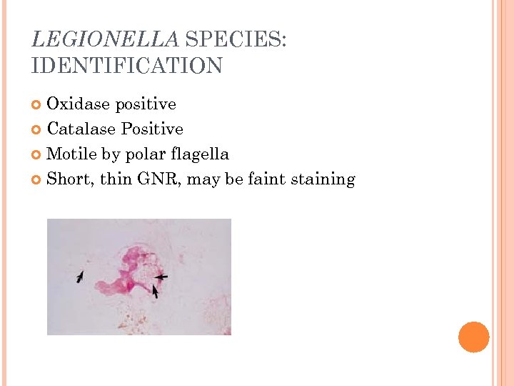LEGIONELLA SPECIES: IDENTIFICATION Oxidase positive Catalase Positive Motile by polar flagella Short, thin GNR,