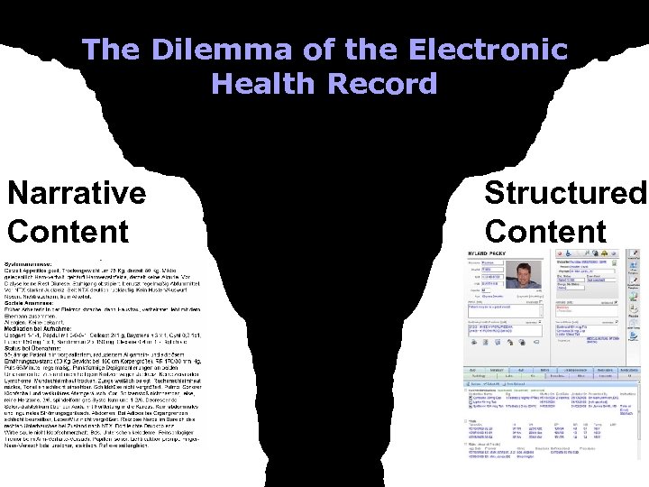 The Dilemma of the Electronic Health Record Narrative Content Structured Content 