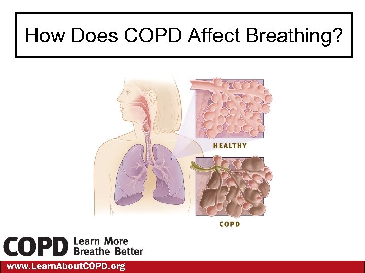 How Does COPD Affect Breathing? www. Learn. About. COPD. org 