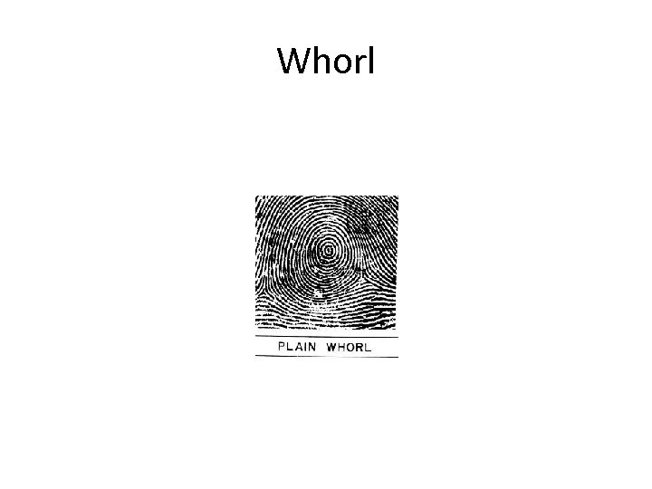 Whorl 