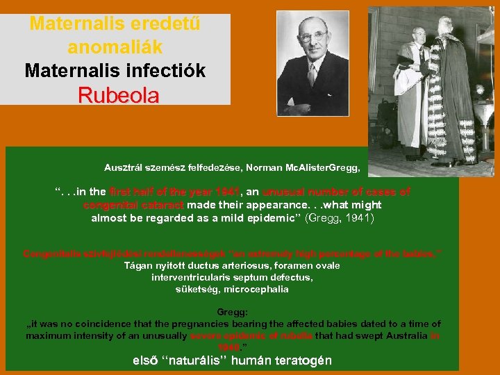 Maternalis eredetű anomaliák Maternalis infectiók Rubeola Ausztrál szemész felfedezése, Norman Mc. Alister. Gregg, ‘‘.