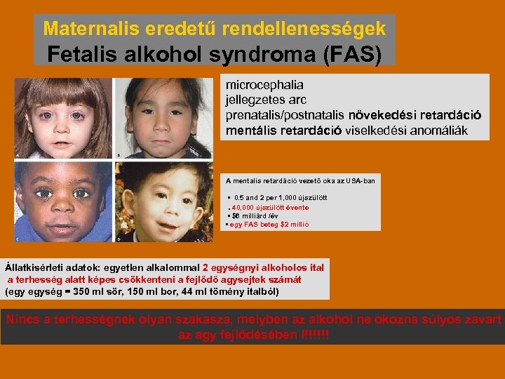 Maternalis eredetű rendellenességek Fetalis alkohol syndroma (FAS) microcephalia jellegzetes arc prenatalis/postnatalis növekedési retardáció mentális