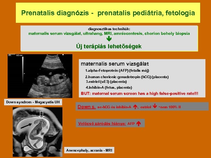 Prenatalis diagnózis - prenatalis pediátria, fetologia diagnosztikus technikák: maternalis serum vizsgálat, ultrahang, MRI, amniocentesis,