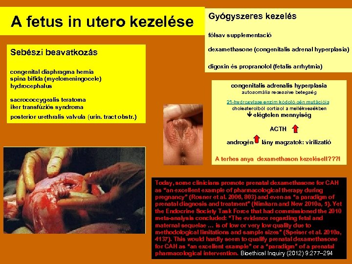 A fetus in utero kezelése Gyógyszeres kezelés fólsav supplementació Sebészi beavatkozás congenital diaphragma hernia