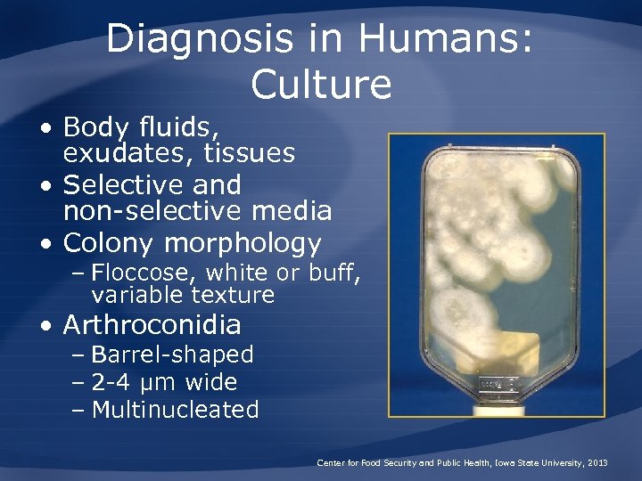 Diagnosis in Humans: Culture • Body fluids, exudates, tissues • Selective and non-selective media