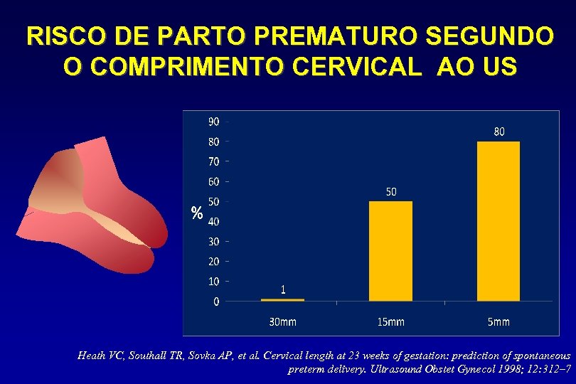 RISCO DE PARTO PREMATURO SEGUNDO O COMPRIMENTO CERVICAL AO US Heath VC, Southall TR,