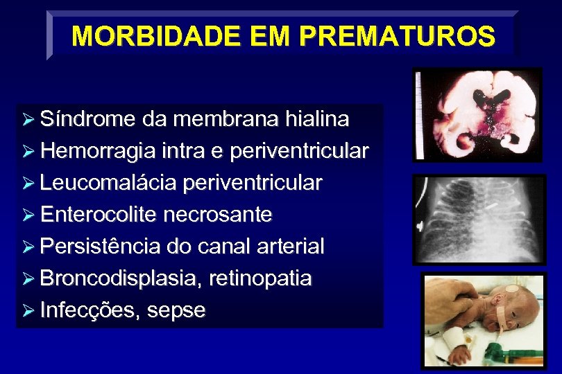 MORBIDADE EM PREMATUROS Ø Síndrome da membrana hialina Ø Hemorragia intra e periventricular Ø