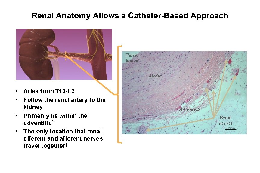 Renal Anatomy Allows a Catheter-Based Approach Vessel lumen Media • Arise from T 10