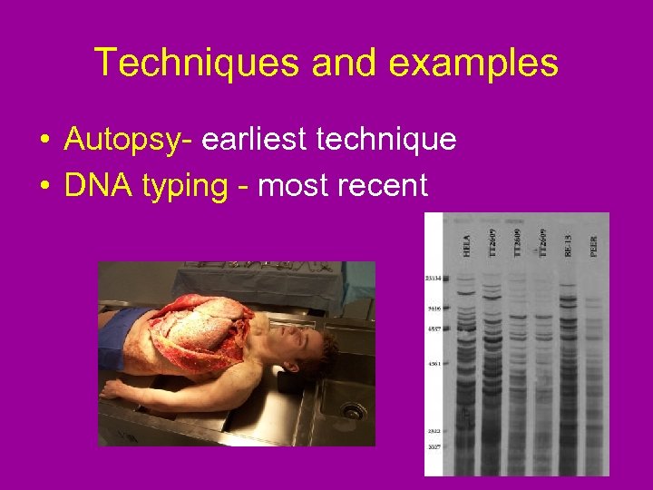 Techniques and examples • Autopsy- earliest technique • DNA typing - most recent 