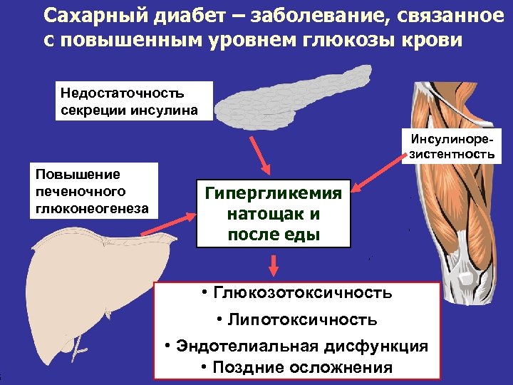 5 Сахарный диабет – заболевание, связанное с повышенным уровнем глюкозы крови Недостаточность секреции инсулина