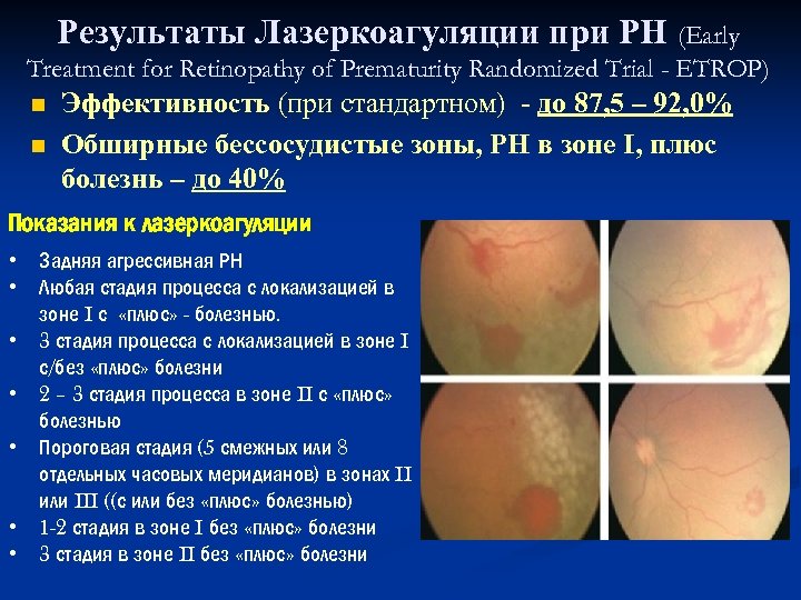 Результаты Лазеркоагуляции при РН (Early Treatment for Retinopathy of Prematurity Randomized Trial - ETROP)