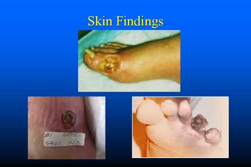 Skin Findings 