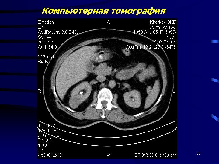 Компьютерная томография 10 