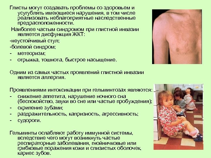 Глисты могут создавать проблемы со здоровьем и усугублять имеющиеся нарушения, в том числе реализовать