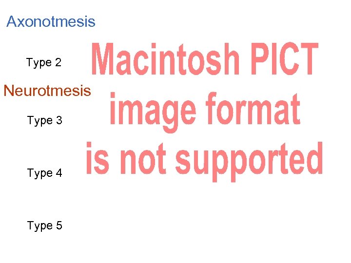 Axonotmesis Type 2 Neurotmesis Type 3 Type 4 Type 5 