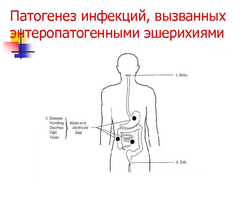 Патогенез инфекций, вызванных энтеропатогенными эшерихиями 