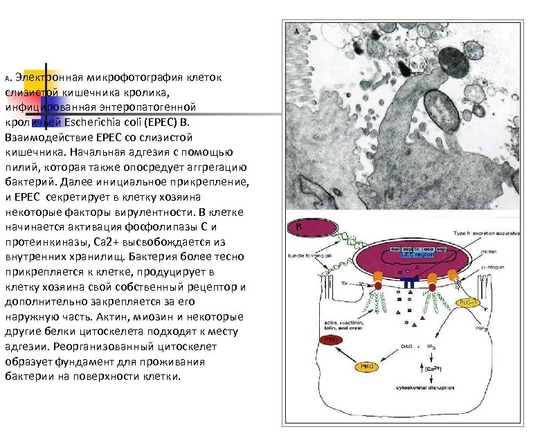 . Электронная микрофотография клеток слизистой кишечника кролика, инфицированная энтеропатогенной кроличьей Escherichia coli (EPEC) B.