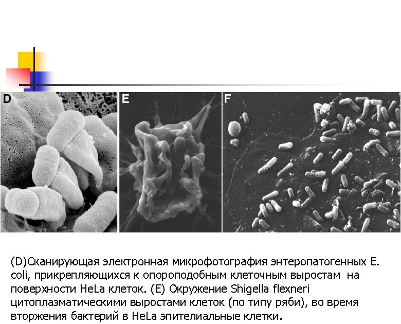 (D)Сканирующая электронная микрофотография энтеропатогенных Е. coli, прикрепляющихся к опороподобным клеточным выростам на поверхности He.