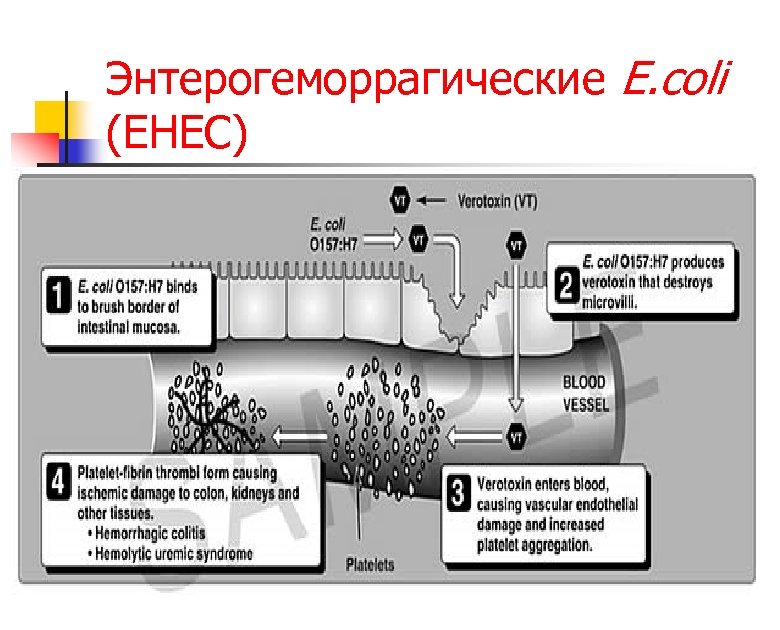Энтерогеморрагические E. coli (EHEC) 