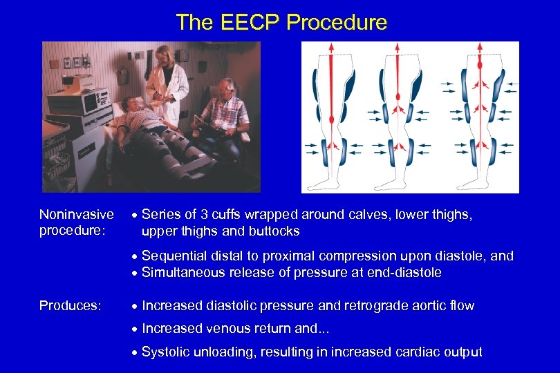 The EECP Procedure Noninvasive procedure: · Series of 3 cuffs wrapped around calves, lower