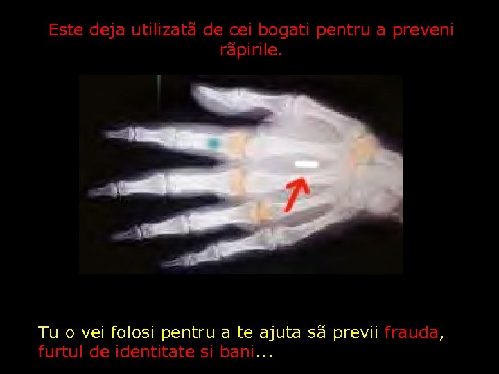 Este deja utilizatã de cei bogati pentru a preveni rãpirile. Tu o vei folosi