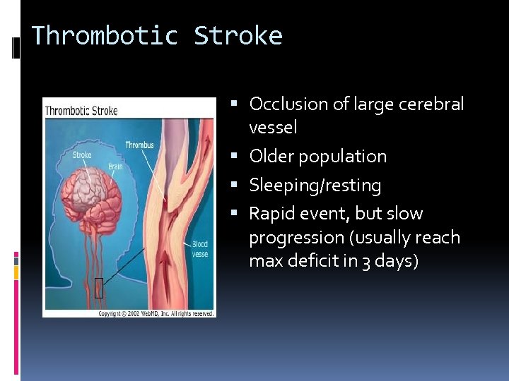 Thrombotic Stroke Occlusion of large cerebral vessel Older population Sleeping/resting Rapid event, but slow