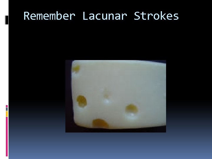 Remember Lacunar Strokes 