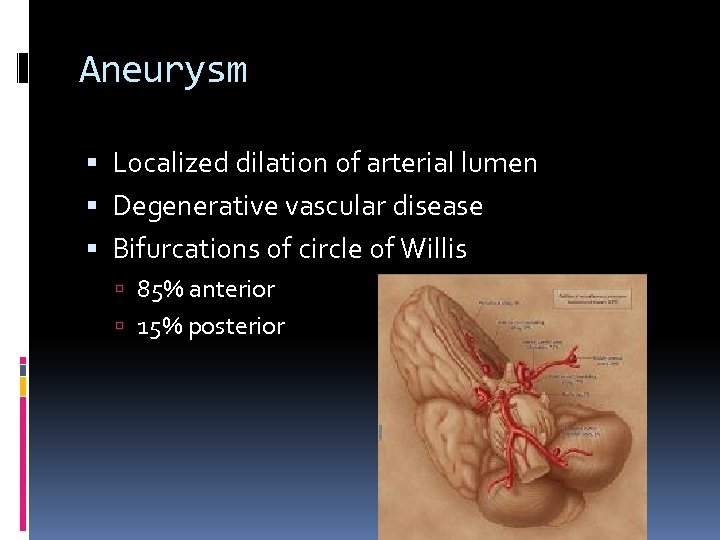Aneurysm Localized dilation of arterial lumen Degenerative vascular disease Bifurcations of circle of Willis