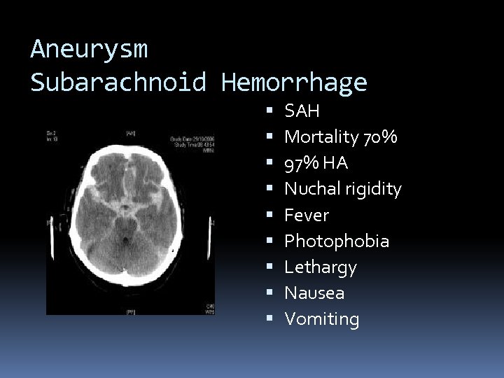 Aneurysm Subarachnoid Hemorrhage SAH Mortality 70% 97% HA Nuchal rigidity Fever Photophobia Lethargy Nausea