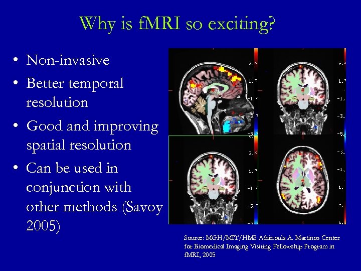 Why is f. MRI so exciting? • Non-invasive • Better temporal resolution • Good